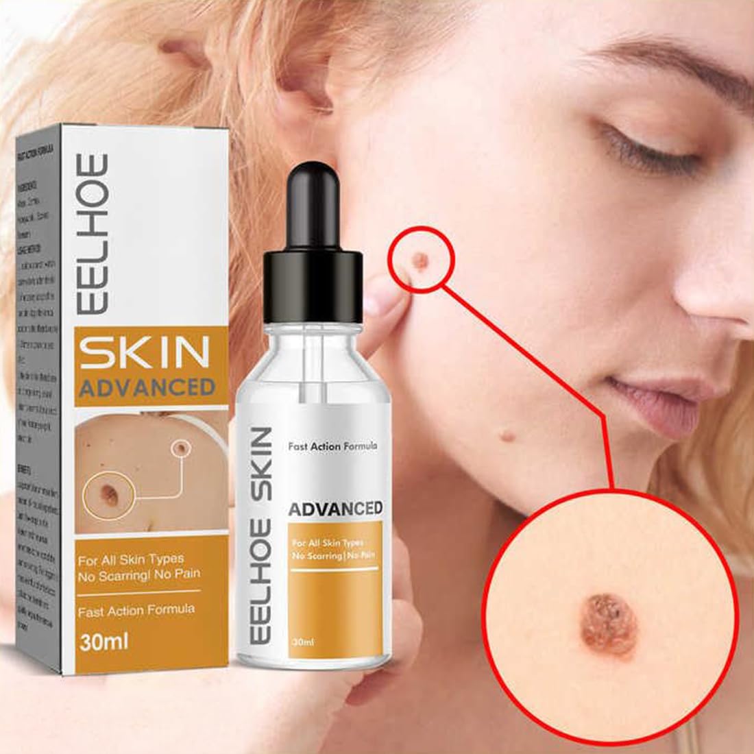 Skin Tag & Mole Remover Serum – Quick-Acting Natural Formula for Face and Body – Simple to Use, 30ML