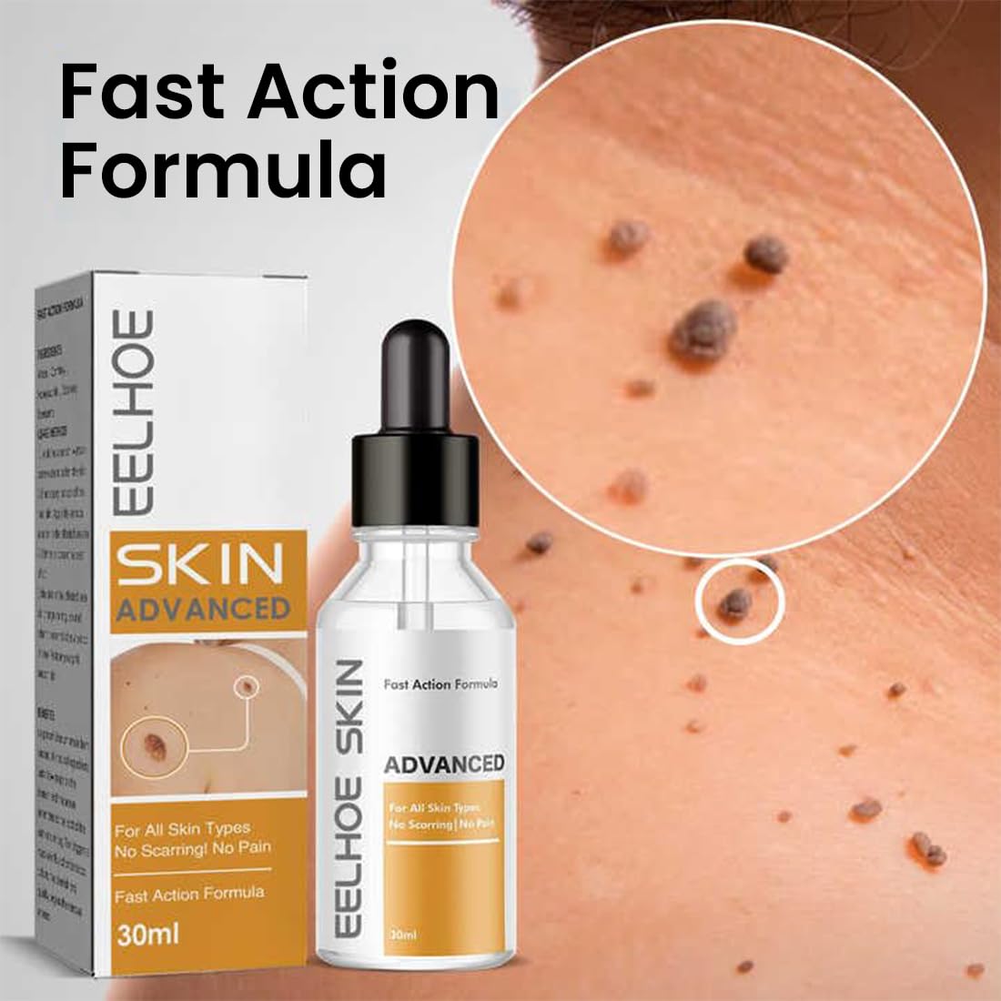 Skin Tag & Mole Remover Serum – Quick-Acting Natural Formula for Face and Body – Simple to Use, 30ML