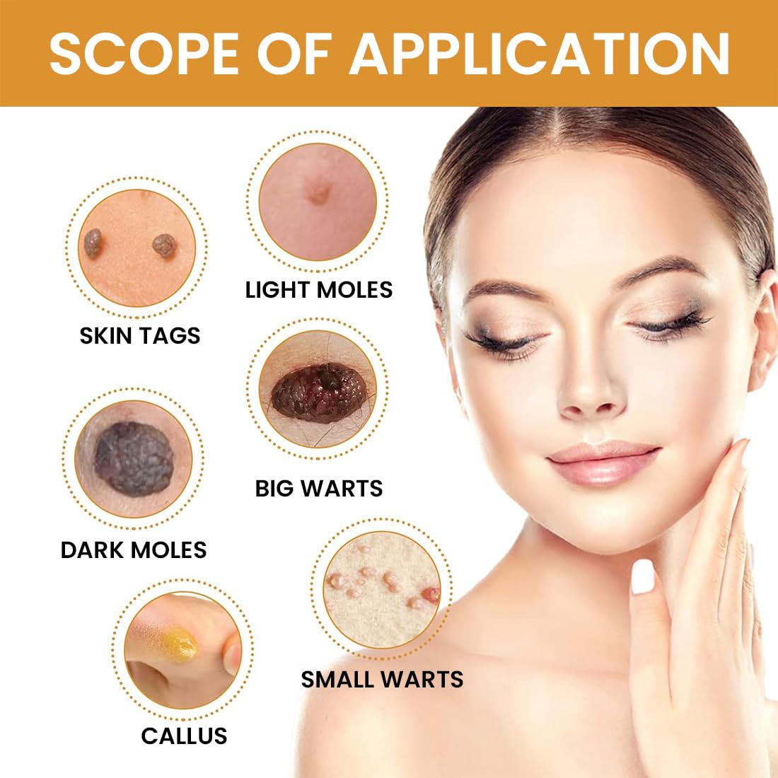 Skin Tag & Mole Remover Serum – Quick-Acting Natural Formula for Face and Body – Simple to Use, 30ML